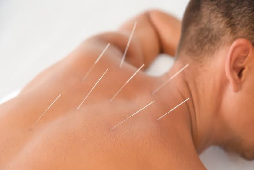 Dapatkan Berat Badan Ideal dan Hidup Sehat dengan Diet Akupunktur RSUD Genteng