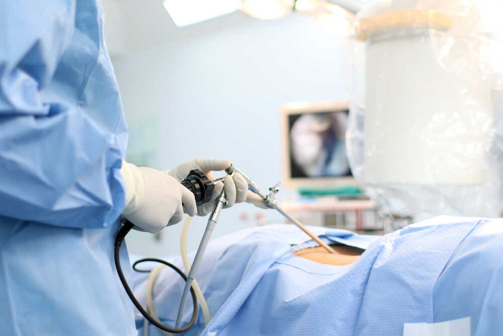 Inovasi RSUD Genteng: Sukses Mengatasi Tumor Ovarium Besar dan Menyediakan Layanan Ginekologi