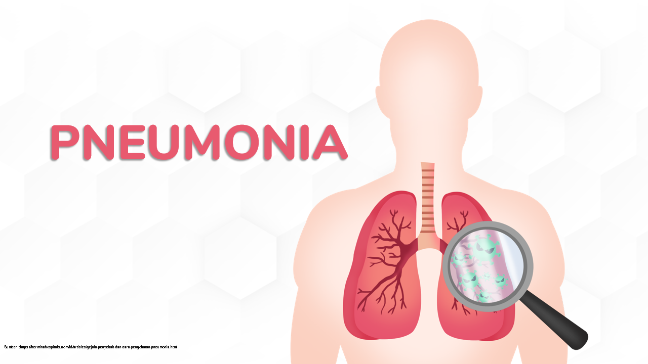 Waspada Pneumonia Misterius: Langkah PHBS dan Vaksinasi sebagai Benteng Pertahanan